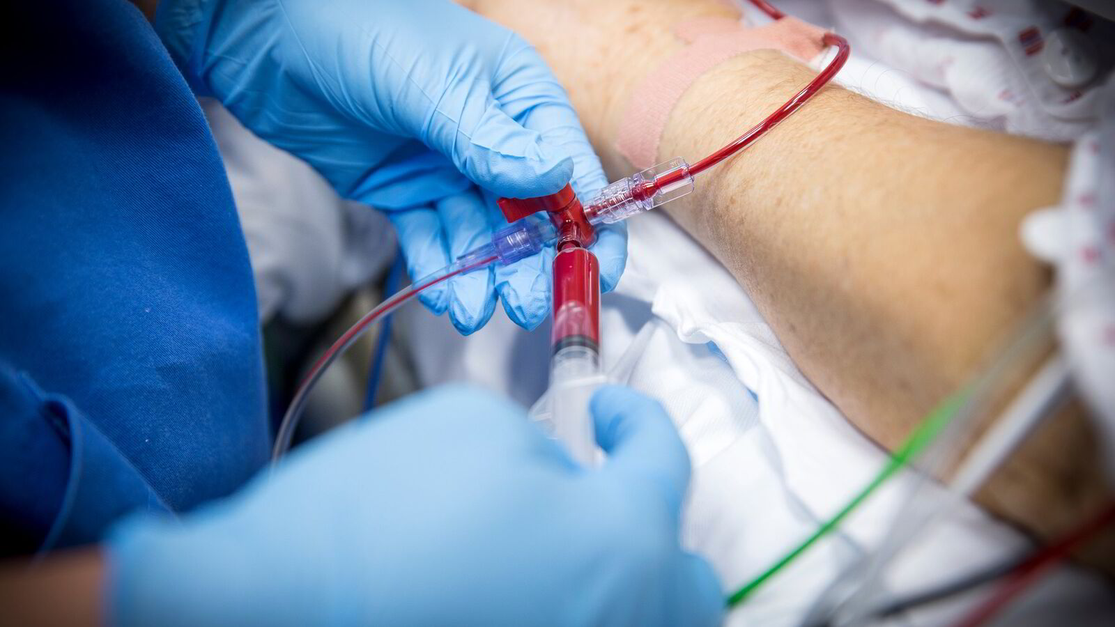 Slutt å telle «start-ups»