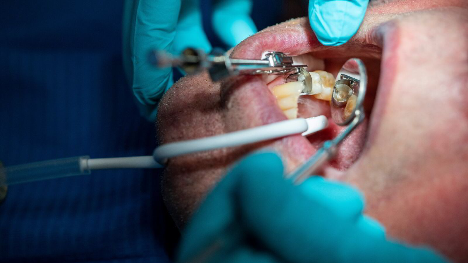 Gratis tannlege – tennene er en del av kroppen