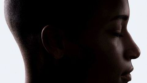 Med Elon Musks hjerneimplantat skal blinde kunne se, døve høre og de lamme gå