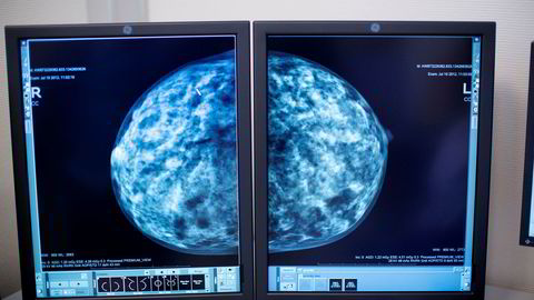 Aleris tilbyr kvinner gratis medlemskap i «Aleris røntgen mammovakt».