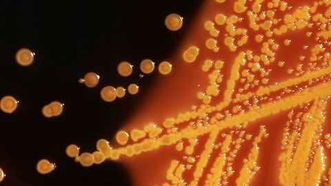 En koloni av E.coli-bakterier under mikroskop. I USA ble det første tilfellet med en E.coli-bakterie som bærer genet mcr-1, registrert i mai i fjor.