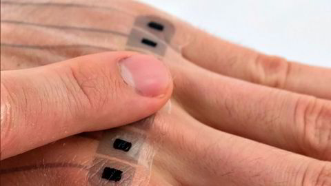 Tyske forskere har utviklet en e-tatovering som kan brukes som fjernkontroll til annen elektronikk. Bildet er bare en prototyp, endelige versjoner skal bli mer diskrete.
